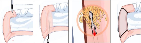 wms倉庫管理系統